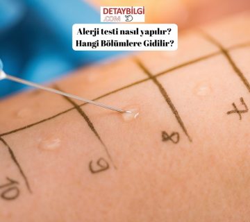 Alerji testi nasıl yapılır? Hangi Bölümlere Gidilir?