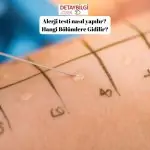 Alerji testi nasıl yapılır? Hangi Bölümlere Gidilir?
