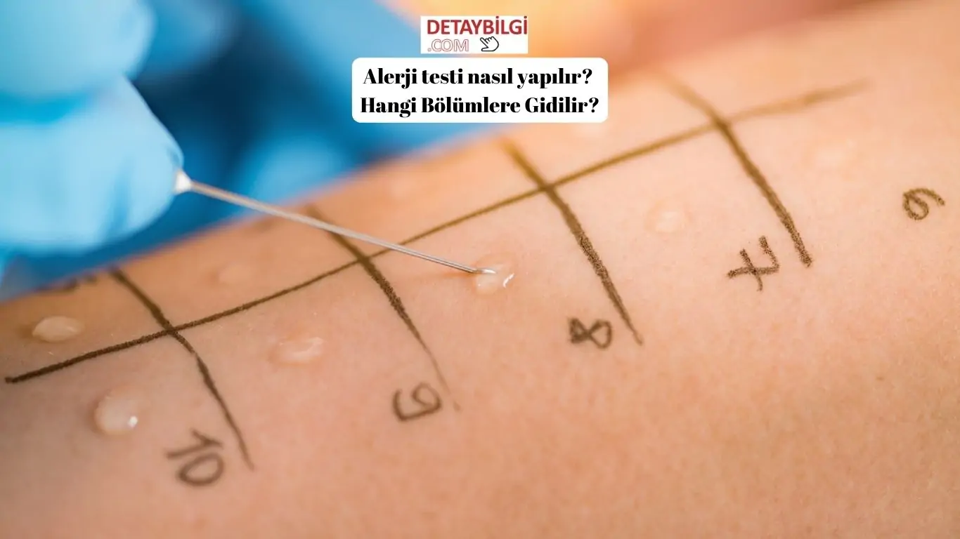Alerji testi nasıl yapılır? Hangi Bölümlere Gidilir?